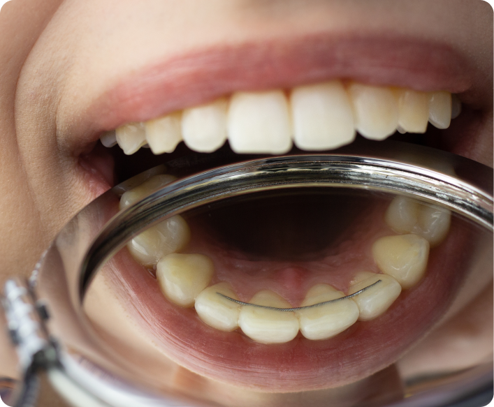 Examen de la bouche à l'aide d'un miroir dentaire