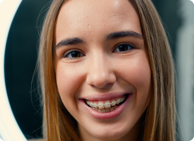 Sourire rapproché d'une adolescente portant des bagues